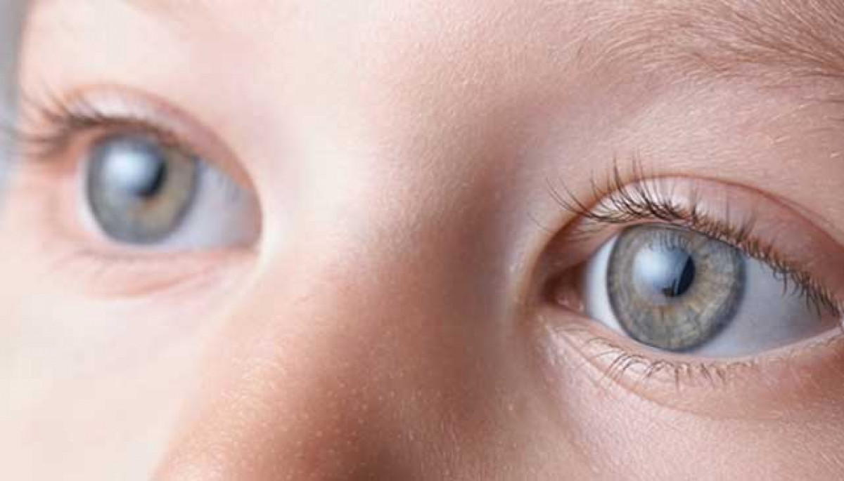 Best Homeopathy Treatment for Cataract