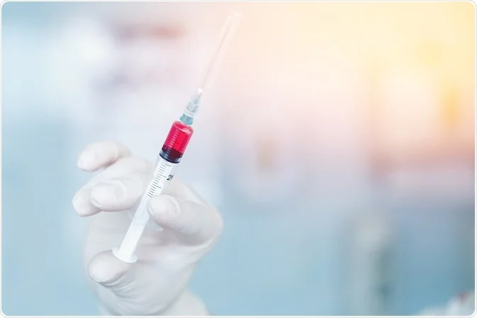 PREVENTION AND CURE OF SWINE FLU (H1N1) BY HOMEOPATHY